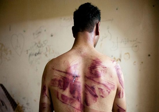 Promotoria aponta 1,4 mil casos de tortura no estado de SP desde 2011