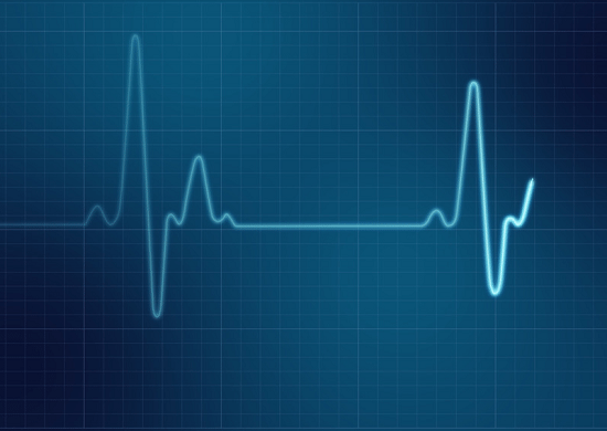 Mortalidade por infarto em Guarulhos cai de 25% para 7,2% dos casos em dois meses