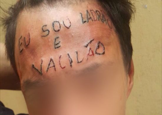 Jovem que teve testa tatuada é preso por furtar desodorantes em supermercado