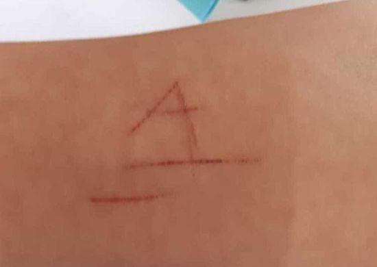 Estudante é dopada, estuprada e tem pulso marcado pela letra ‘A’ em SP