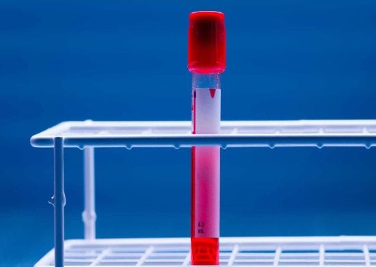 Pesquisa que usou corante para combater câncer ganha prêmio