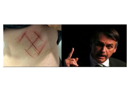 Bolsonaro espera retratação sobre caso de mulher marcada com suástica