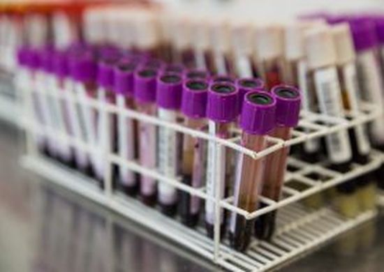 Estoques da Pró-Sangue diminuem por causa das férias