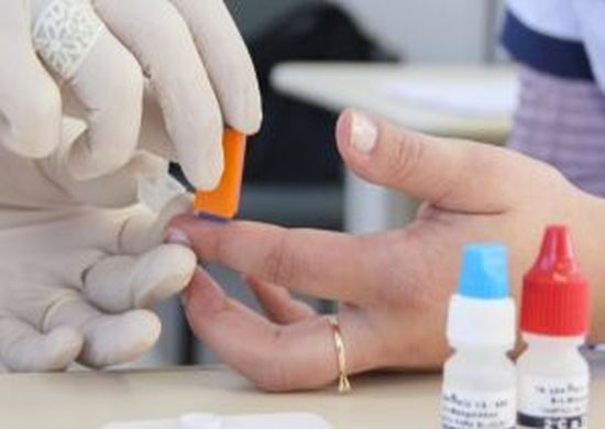 USP busca voluntários para testar nova droga de prevenção ao HIV