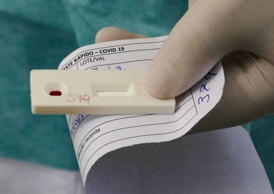 COVID-19: Ministério anuncia novos critérios para caracterizar casos da doença
