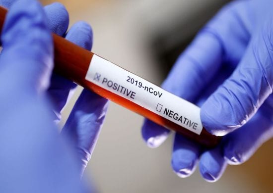 Covid-19: Estado de SP contabiliza mais de 400 óbitos em um dia