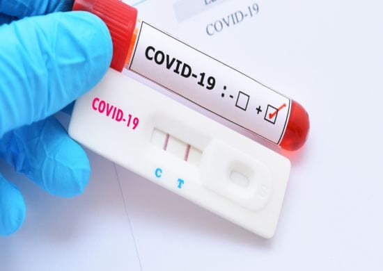 COVID-19: ANS vai decidir se teste é obrigatório nos planos de saúde