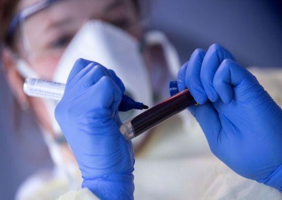 COVID-19: Planos de saúde não são obrigados a cobrir testes