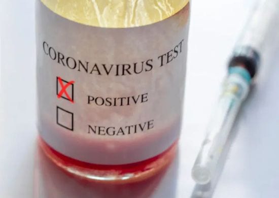 Anvisa estende prazo de validade de testes de covid-19