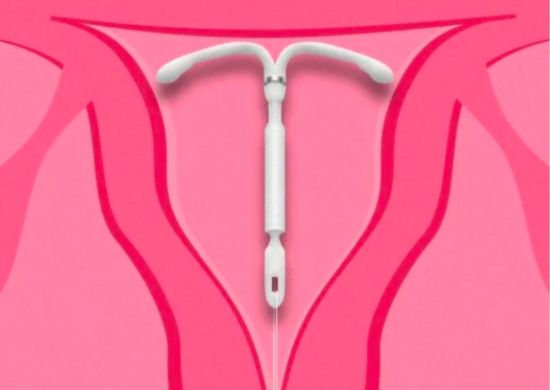 SP: Procon notifica seguradoras sobre consentimento de marido para DIU