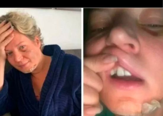 Polícia conclui que Joice Hasselmann sofreu “queda da própria altura” e descarta agressão