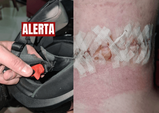 Prefeitura chama a atenção para o risco de morte de motociclistas por acidentes com cerol