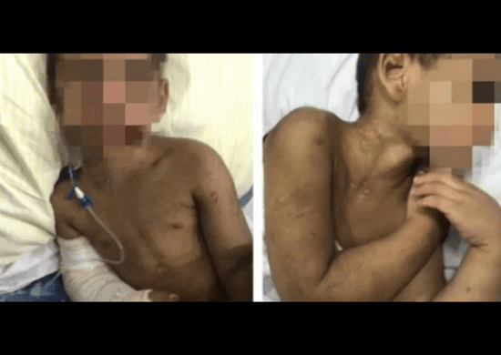 Padrasto que espancou e quebrou costelas de menino de 4 anos junto com mãe é encontrado morto