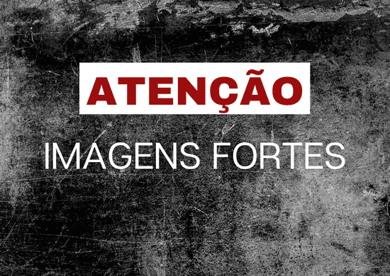 Suspeita de maus-tratos e tortura, mãe é presa após fazer crianças de 4 e 6 anos ficarem de joelhos sobre tampinhas de garrafa