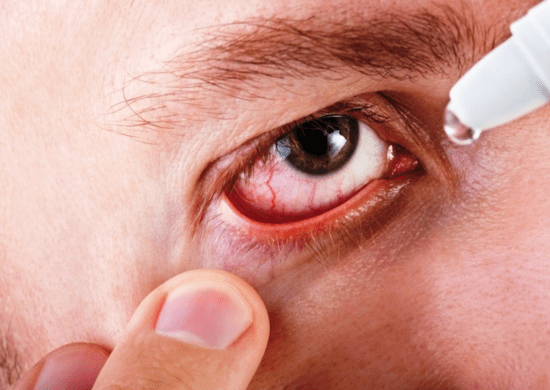 Ozonioterapia não deve ser usada para doenças oculares, alerta Conselho de Oftalmofologia