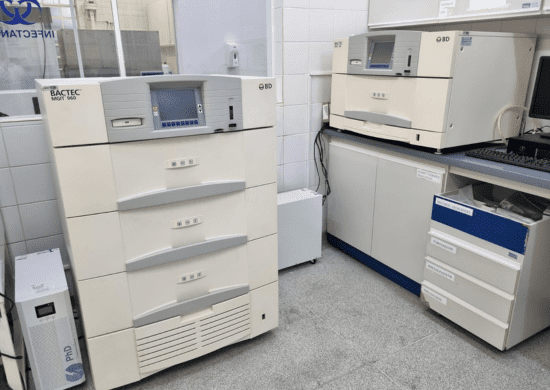 Guarulhos utiliza nova técnica que reduz para 45 dias o tempo do diagnóstico da tuberculose