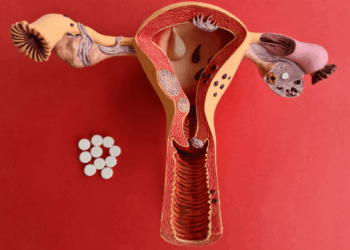 SUS vai ofertar novos tratamentos para endometriose